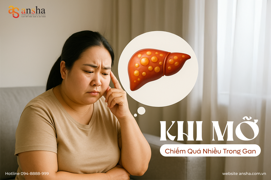 Khi mỡ - cholesterol xấu chiếm quá nhiều trong gan